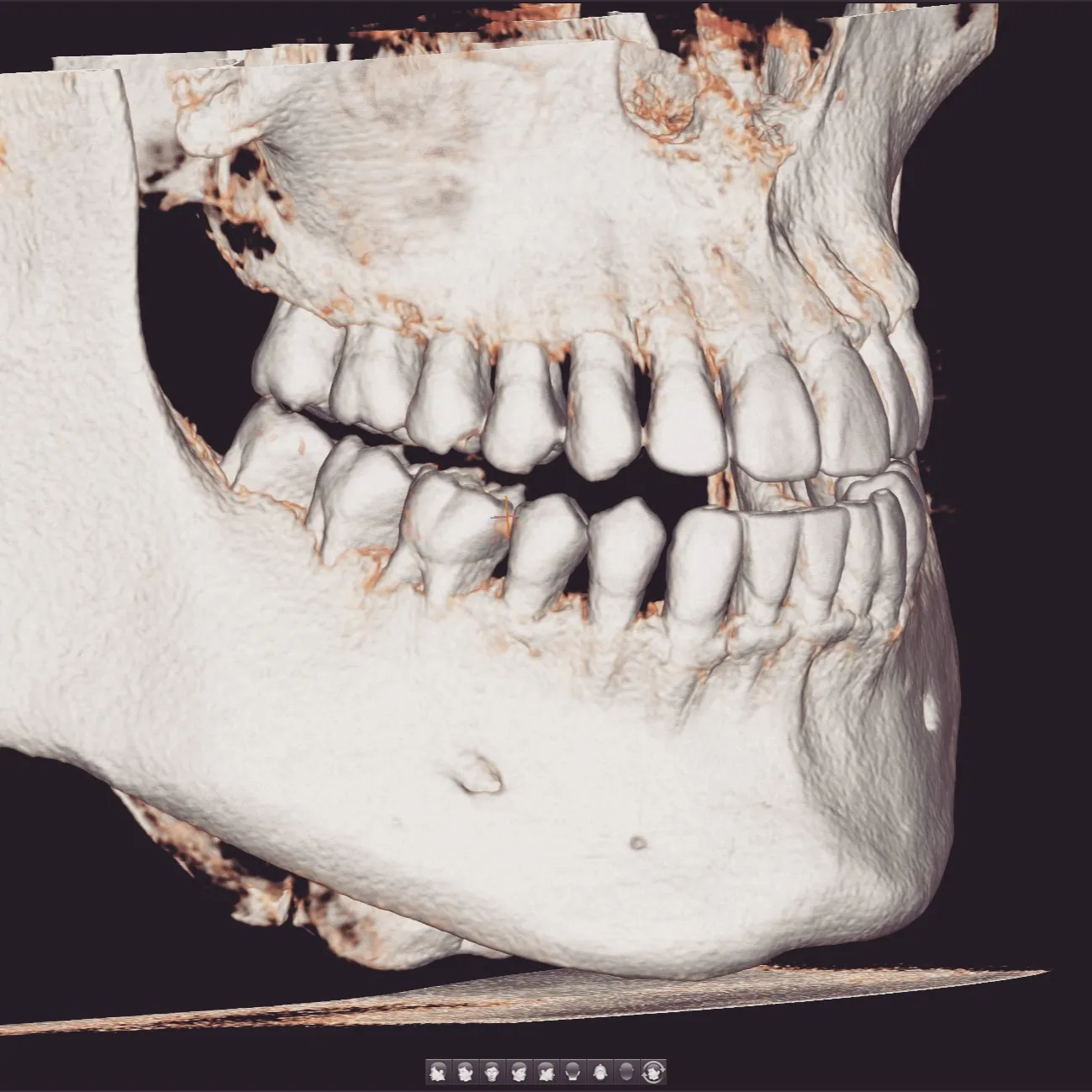 🦷 藤花歯科医院のCT、こんなに見えてます📸