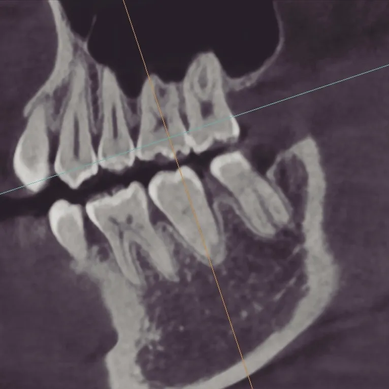 🦷 藤花歯科医院のCT、こんなに見えてます📸